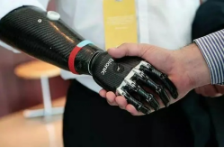 CFRP prosthetic limb