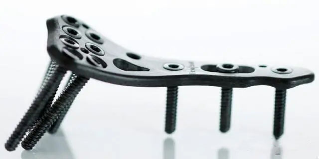 Carbon fiber PEEK spinal implant.webp